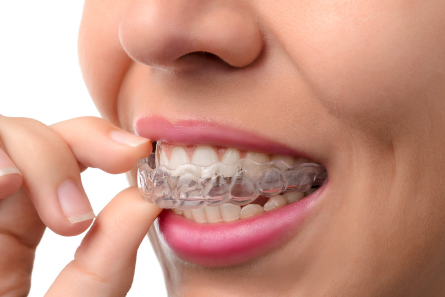 Closeup of a woman wearing Invisalign from Signature Dental Care, her Invisalign dentist in Hickory Hills, IL
